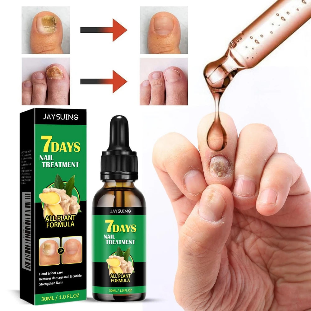 Aceite de Jengibre para Cutículas