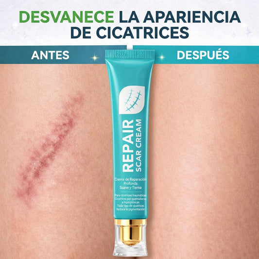 SADOER Crema Reparadora de Cicatrices