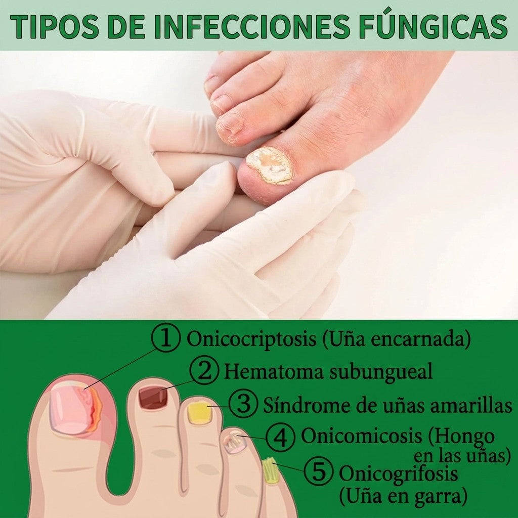 Aceite de Jengibre para Cutículas