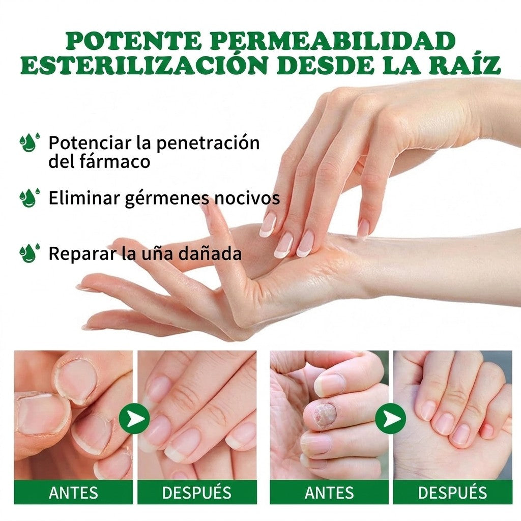 Aceite de Jengibre para Cutículas