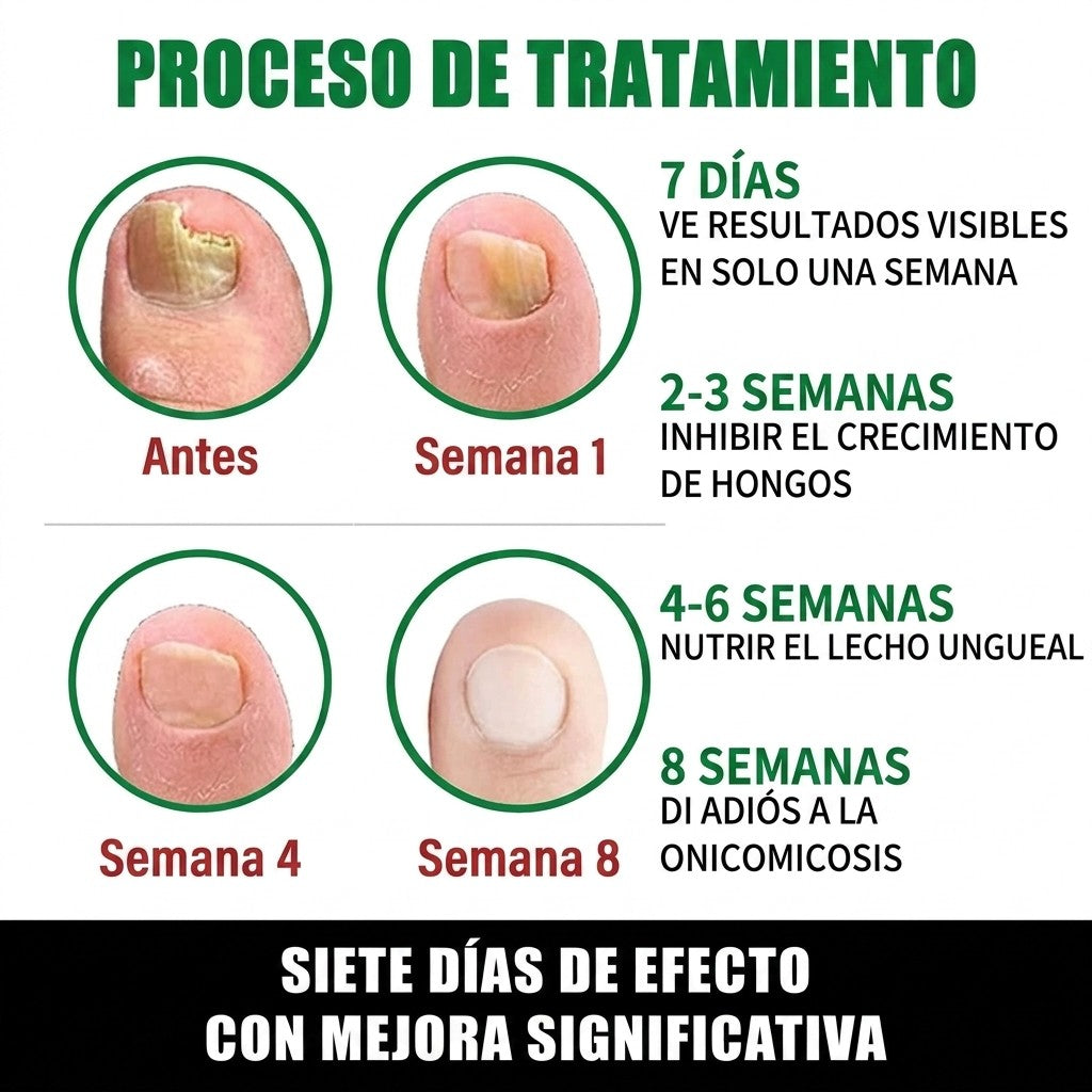 Aceite de Jengibre para Cutículas